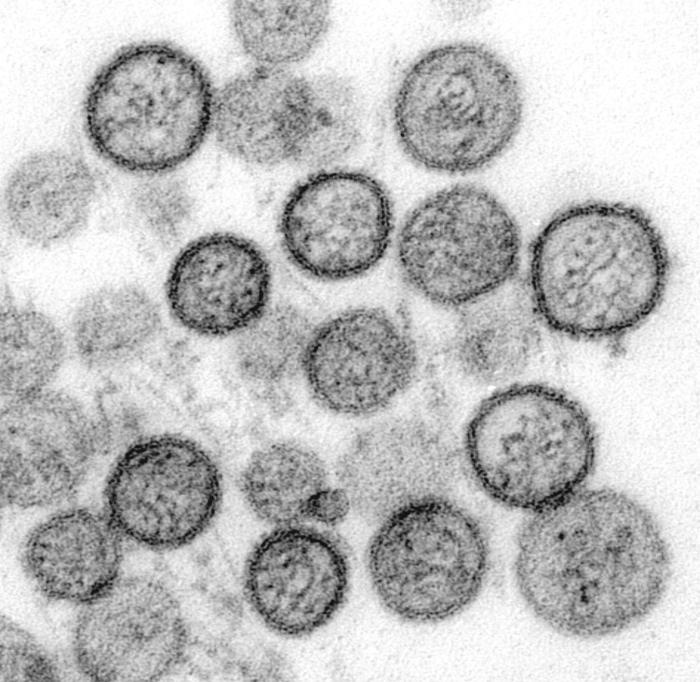 Transmission electron micrograph of Sin Nombre virus particles.